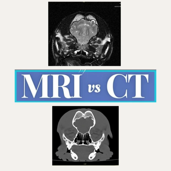 MRI i CT