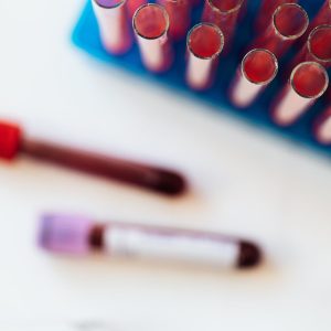Hematologia