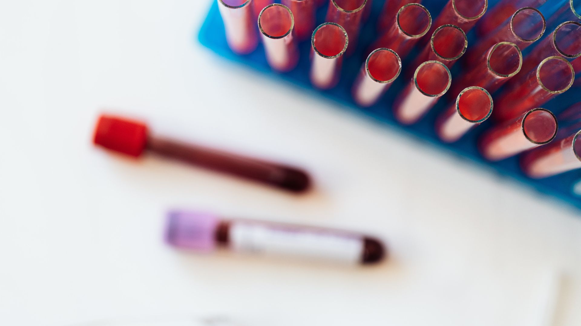 Hematologia