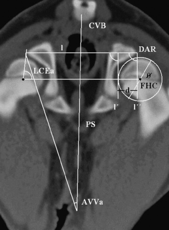 Dysplazje w TK pomiary