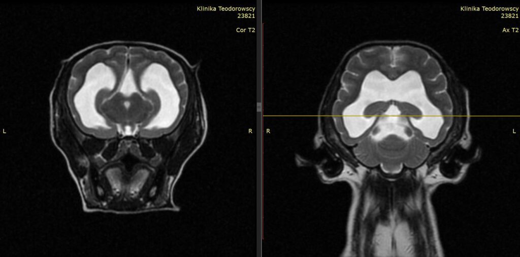 MRI wodogłowie psa